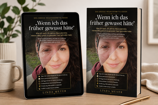 Neurodermitis E-Book "Wenn ich das früher gewusst hätte"